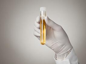 生物标志物指导的分诊能否降低社区获得性fUTI住院率？