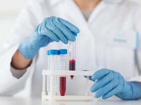 离奇！表现为心内膜炎和肝炎 却找不到病原菌