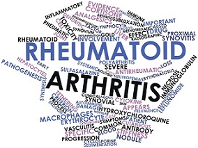 类风湿关节炎患者服用阿托伐他汀 心血管事件风险可减少34%