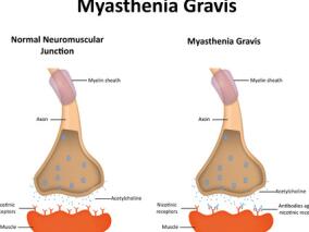 中年男子“感冒”吃药无缓解 第5天竟开始呼吸困难