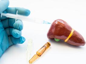 晚期肝细胞癌:索拉非尼联合普伐他汀不能进一步改善生存期