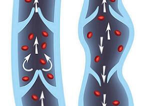 利妥昔单抗诱导和维持肉芽肿伴多血管炎的治疗效果如何?