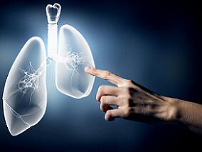 EGFR阳性晚期NSCLC：贝伐珠单抗联手TKI可赢得更多生机