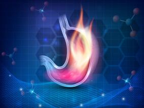 局部晚期胃癌患者:腹腔镜下远端胃切除术+D2淋巴结切除术未来可期