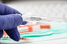 中度COVID-19：瑞德西韦到底有没有作用？