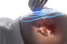 当孕妇遭遇新冠 是否增加不良妊娠结局?