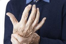 哪些类风湿性关节炎患者容易不依从甲氨蝶呤治疗？