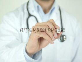 心血管高遗传风险的动脉粥样硬化病患者 依洛尤干预获益大