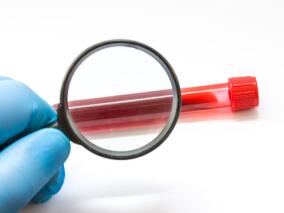 左室附壁血栓患者 抗栓治疗预后如何?