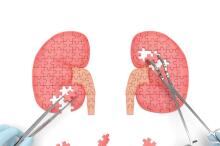 NVAF合并IV-V期CKD患者：利伐沙班vs华法林