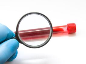 降低静脉血栓栓塞风险 PCSK9抑制剂或是不错的选择