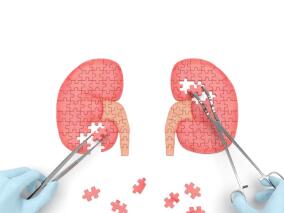 严重到需要透析的急性肾损伤患者 长期使用PPI还安全吗?