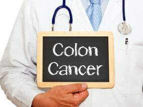 降低林奇综合征患者的结直肠癌风险 阿司匹林能否堪当大任？