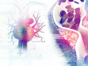 老爷爷三五不时就会头晕还日趋严重 查颈动脉彩超发现病因