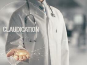 中年男子反复胸闷气喘还时不时跛行 可能不单是心脏病…