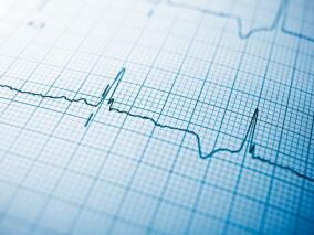 老爷爷腹泻没好又出现心悸 心电图检查发现病因