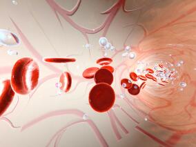 早期伊马替尼疗效不佳的慢性阶段的慢性粒细胞白血病 达沙替尼或可力挽狂澜