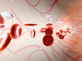 时不时胸闷、喘不上气 有可能得了非霍奇金淋巴瘤