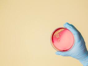 引起新生儿迟发性菌血症的凝固酶阴性葡萄球菌难对付?头孢唑林或能降服