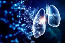 T790M突变的EGFR+晚期NSCLC二线治疗：奥希替尼+贝伐珠单抗vs奥希替尼