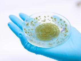 新冠肺炎相关毛霉菌病知多少?最新系统评价来了…