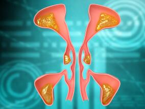 右侧颈部淋巴结肿大7个多月 自行服药后又出现了耳鸣