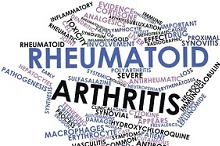 治疗活动性类风湿性关节炎 SDZ-RTX堪比Ref-RTX
