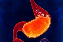 局部胃肠道间质瘤术后:伊马替尼辅助治疗vs不治疗