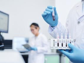 乌司奴单抗的峰值浓度与克罗恩病患者的内镜缓解相关