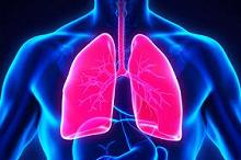 59岁女性发热伴双肺阴影 按社区获得性肺炎经验性治疗效果不佳