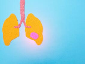 肺动脉高压患者:利奥西呱vs磷酸二酯酶-5抑制剂