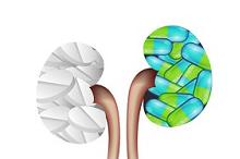 慢性肾病患者的血小板功能如何变化？最新系统评价和荟萃分析来了