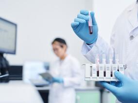 新冠肺炎康复期血浆:供者抗体滴度的预测因素有哪些?受者抗体应答如何?