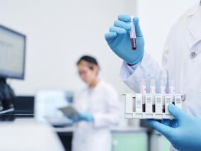 注意了!中年血清钠超过142mmol/L 易发生左心室肥厚和心衰