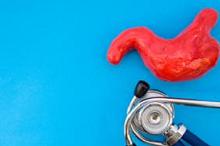 詹文华教授：评估胃癌临床结局不只有冰冷数据 试试以患者为中心