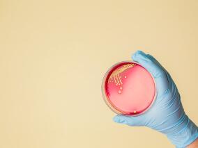 复杂金黄色葡萄球菌菌血症：头孢比罗酯pk达托霉素