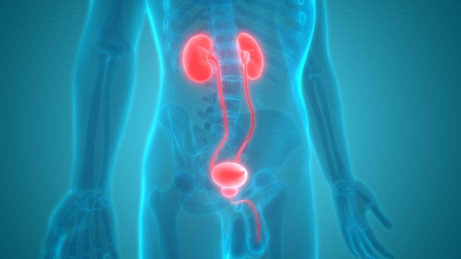 个体化 VS 标准10天抗生素疗程在儿童发热性尿路感染中的疗效与安全性研究