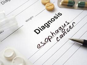 一例下咽癌合并早期食管癌及同步放化疗诊治经验分享